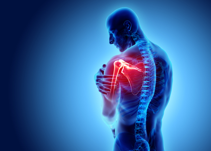 Frozen Shoulder